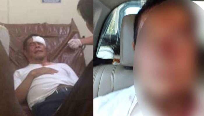 Ricuh, Pj Gubernur Terluka saat  mengawal Jenazah Lukas Enembe